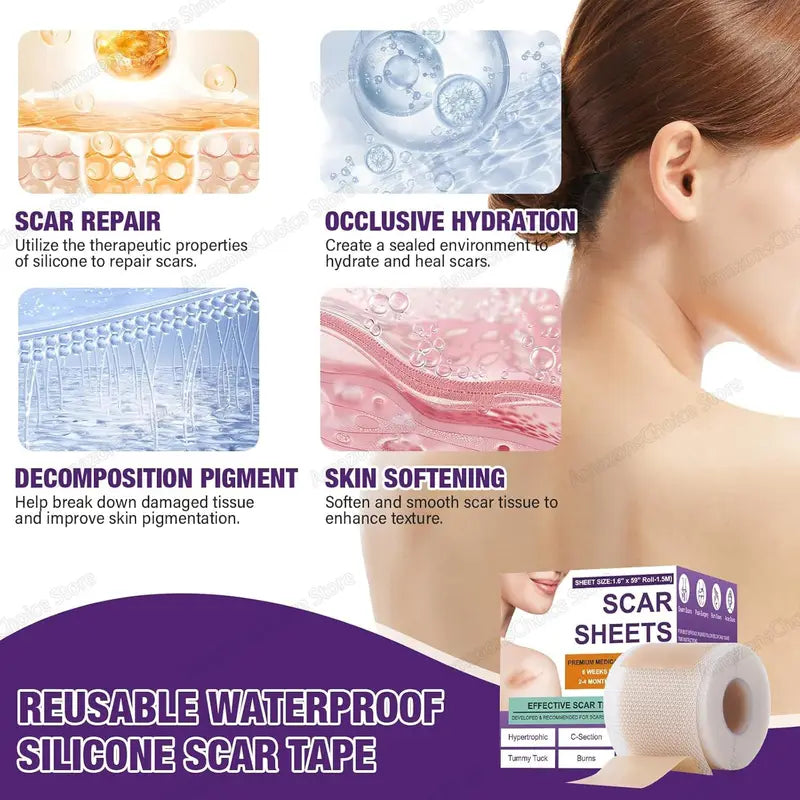 Silicone Scar Removal Sheets - Keloid, Acne, Burn Treatment, 0.5M-3M Size