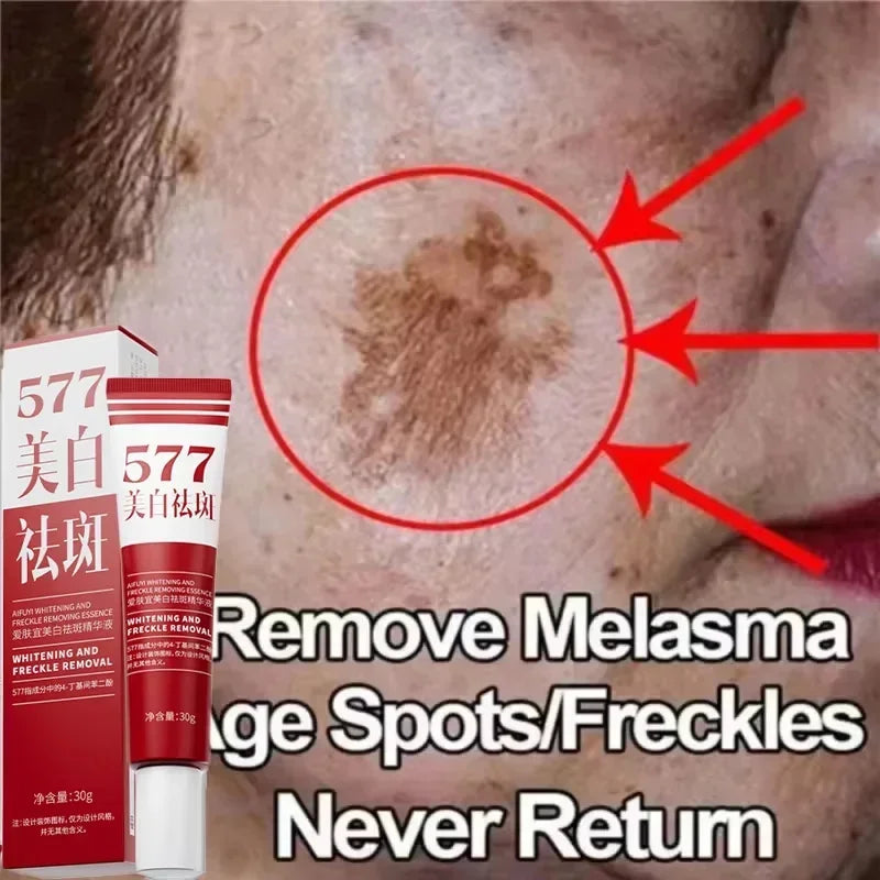 Whitening Face Cream for Dark Spots & Melasma - Brightening & Anti-Aging Skin Care