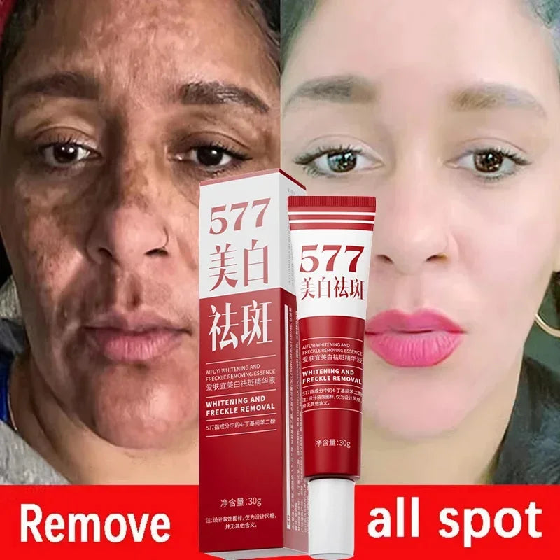 Whitening Face Cream for Dark Spots & Melasma - Brightening & Anti-Aging Skin Care