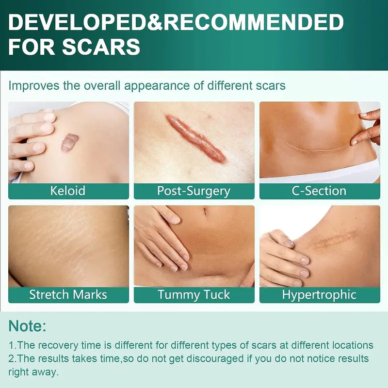 Silicone Scar Treatment Sheets Roll Reusable Strips for Keloid & Burn Scars