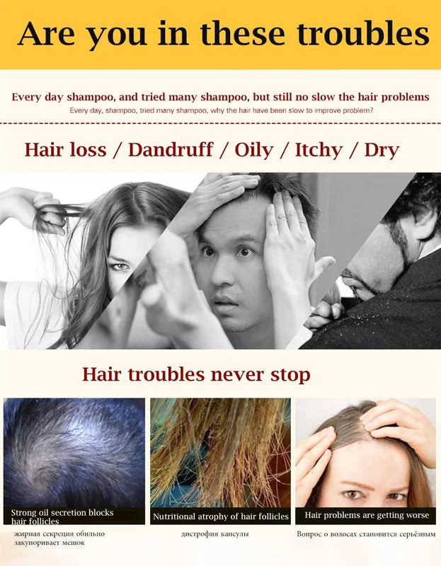 Ginger Hair Loss Shampoo for Damaged Dry Oily Scalp Repair & Growth