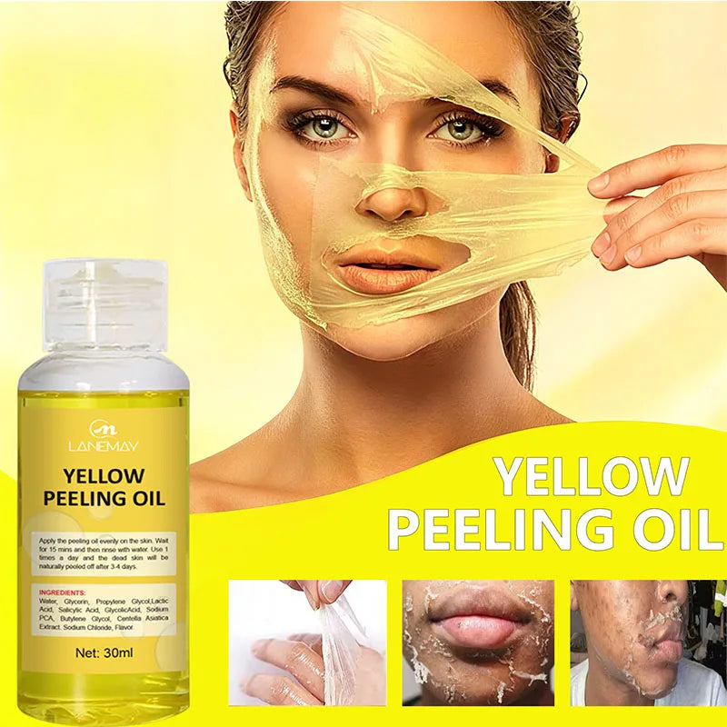 Strong Yellow Peeling Oil for Dark Skin Brightening & Exfoliation - Body & Hands