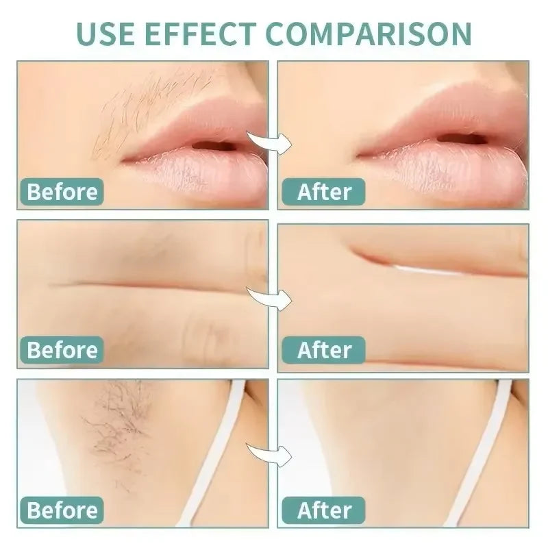 20 Pcs Professional Hair Removal Wax Strips for Body & Face - Cold Depilation