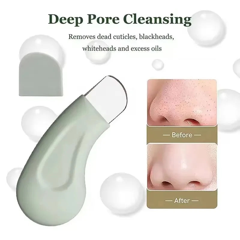 Blackhead and Whitehead Removal Tool for Nose and Face - Skin Pore Cleaner for Women