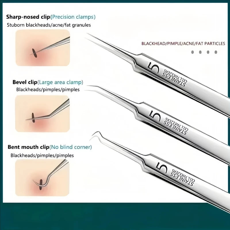 8-Piece Stainless Steel Acne Needle Tool Set for Blackhead Removal & Home Skin Care