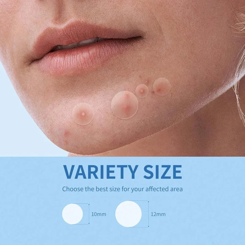 Hydrocolloid Acne Pimple Patches - Invisible Oil-Absorbing Spot Cover, Waterproof, 200/400/800PCS