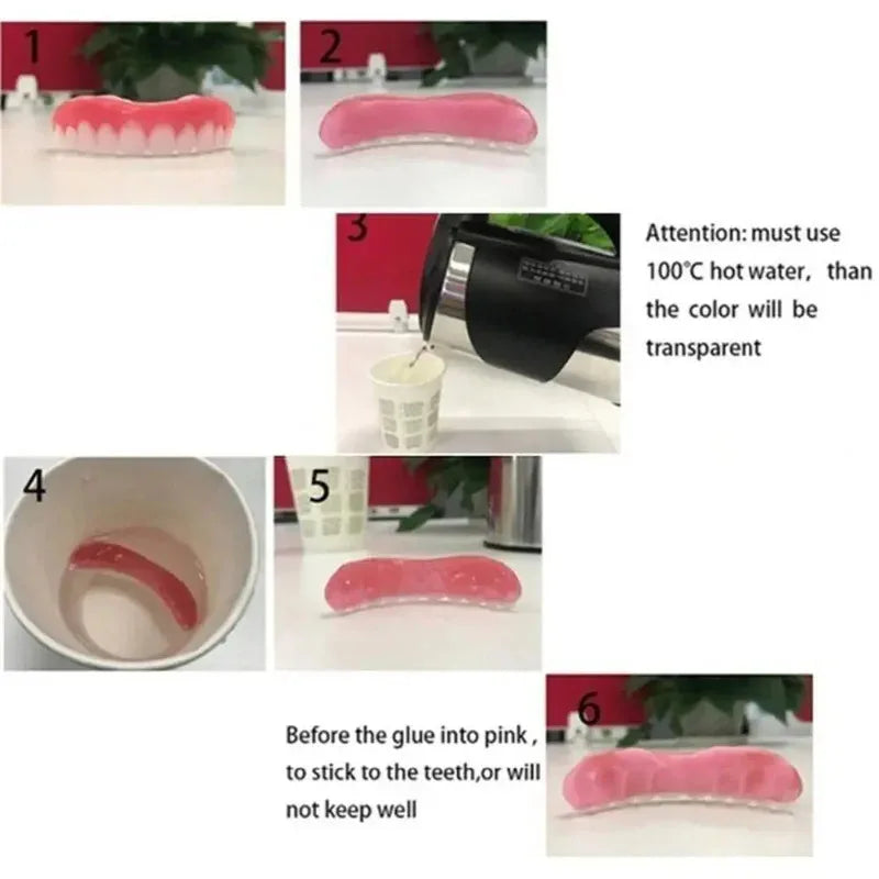 Denture Silicone Kit with Soft Liners - Upper & Lower Denture Repair Set