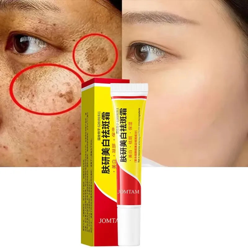 Whitening Freckle Cream for Face Brightening & Melasma Reduction - Niacinamide Skin Care