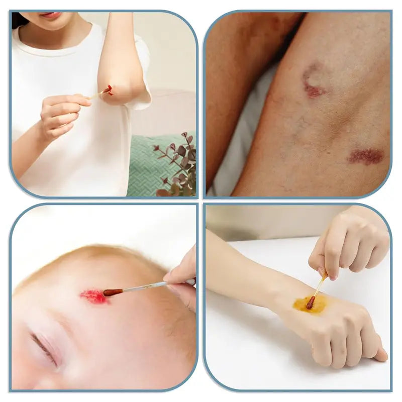 Disposable Iodine Cotton Swabs with Individual Packaging for First Aid & Wound Care