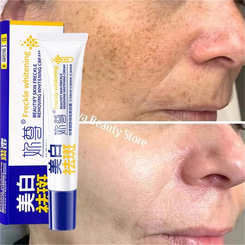 Brightening Spot-Removing Skin Cream for Melasma Dark Spots & Pigmentation - All Colors