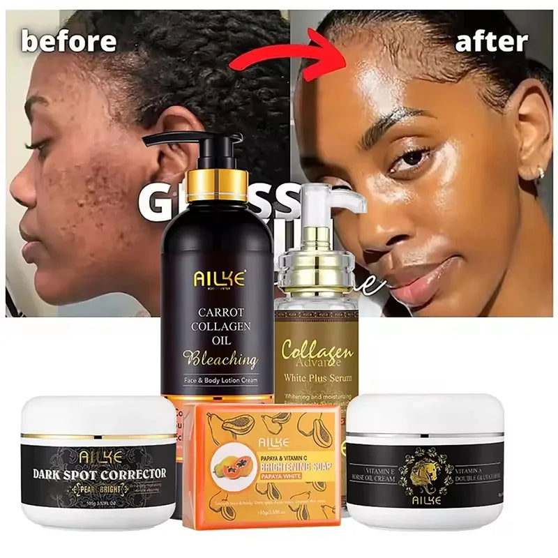 Collagen Whitening Set with Hydrating Body Lotion & Dark Spot Corrector
