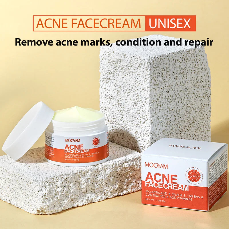 Herbal Acne Face Cream for Scar Lightening Pore Shrinking & Oil Control