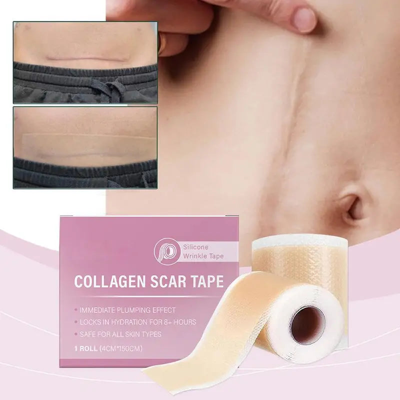Silicone Scar Sheet Waterproof Breathable Painless Scar Repair Tape 4.2x5cm