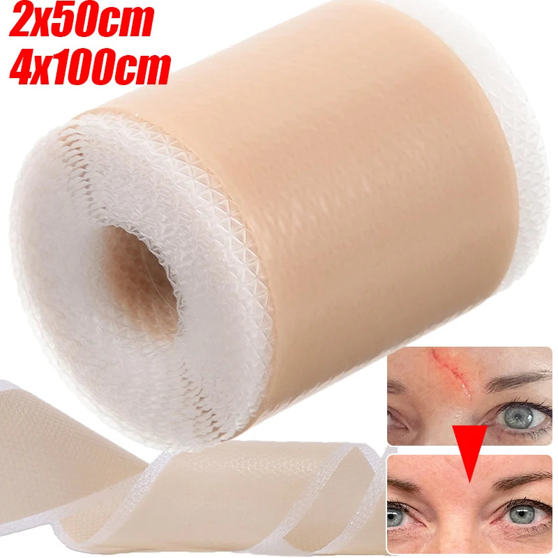 Silicone Self-Adhesive Scar Cover Patches Waterproof Skin Care Tape - Tattoo, Skin, Body