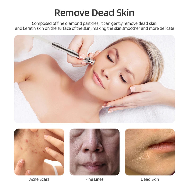Deep Cleansing Facial Peeling Device for Skin Care & Pore Refinement