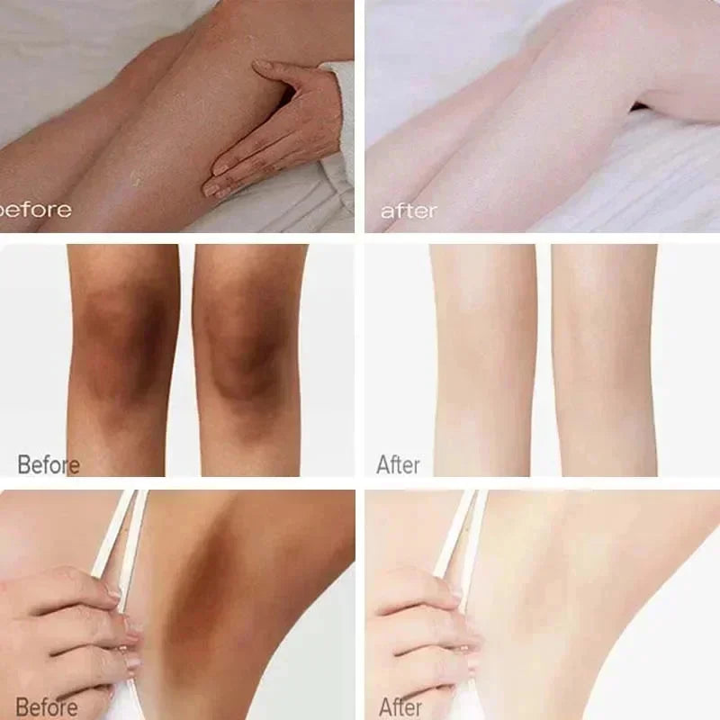 Body Whitening Cream for Dark Skin - Melanin Removal & Brightening Lotion
