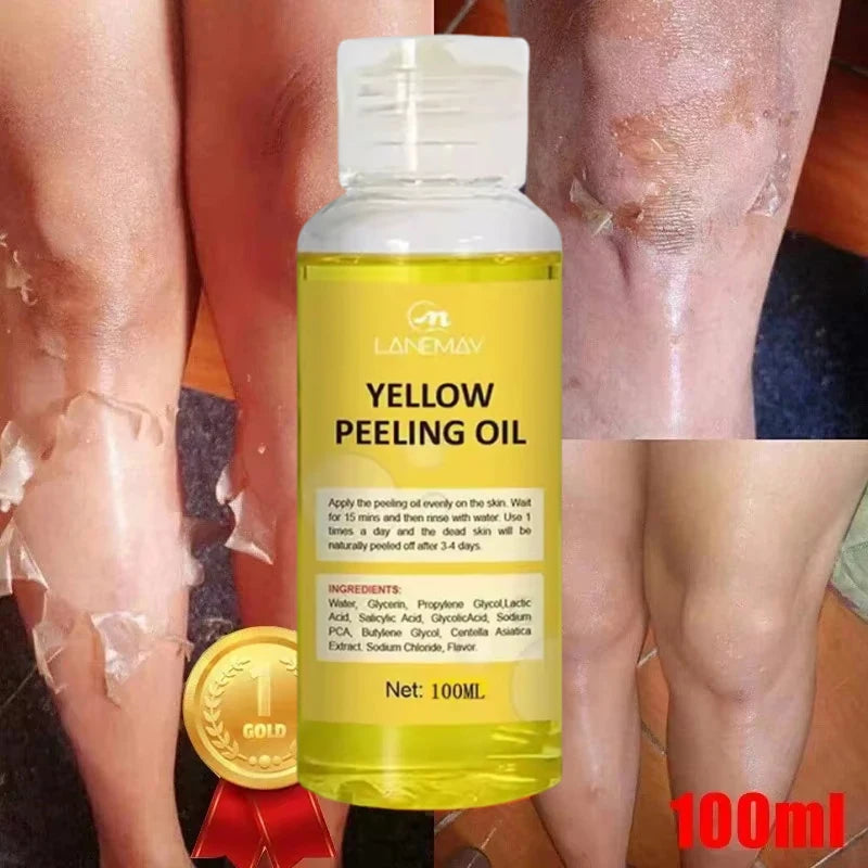 Yellow Peeling Oil for Skin Lightening and Exfoliation - Body & Face
