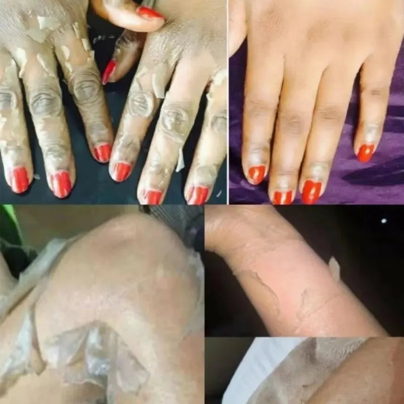 Strong Yellow Peeling Oil for Dark Skin Lightening & Exfoliation - Body & Hands