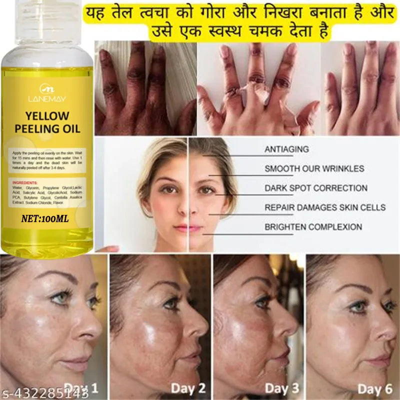 Strong Yellow Peeling Oil for Skin Lightening & Exfoliation - Dark & Brightening Lotion
