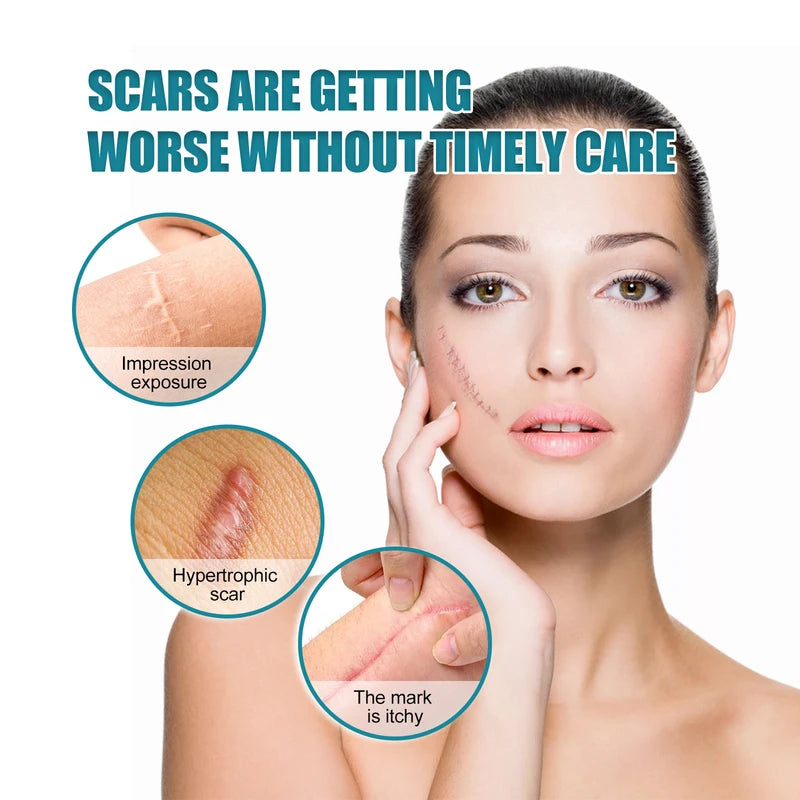 Reusable Silicone Scar Sheets for Surgical & Hypertrophic Scars - Medical Grade, Custom Fit
