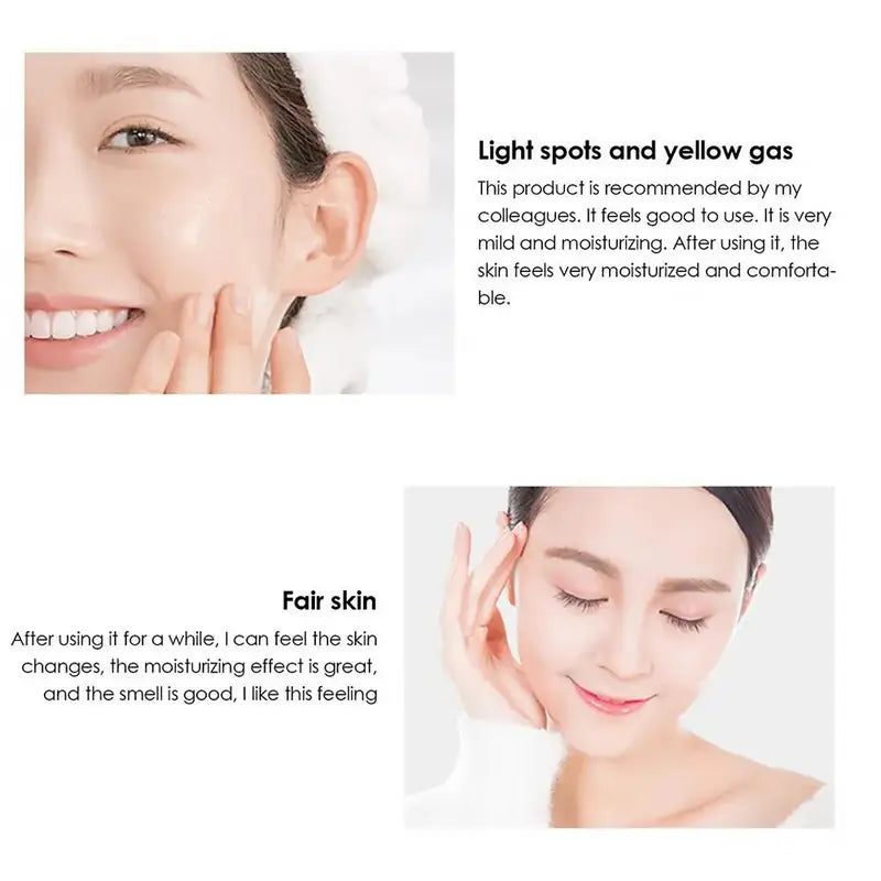 Whitening Face Cream for Dark Spot & Freckle Removal - Brightening Skin Care