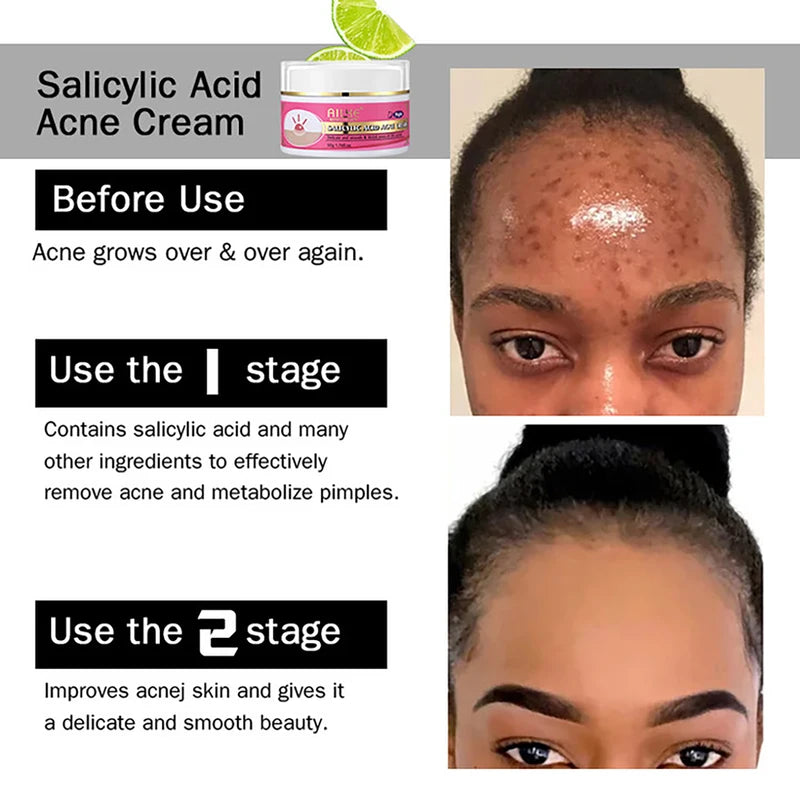 Skin Brightening & Moisturizing Set for Women - Anti-Acne, Radiance Kit with Niacinamide