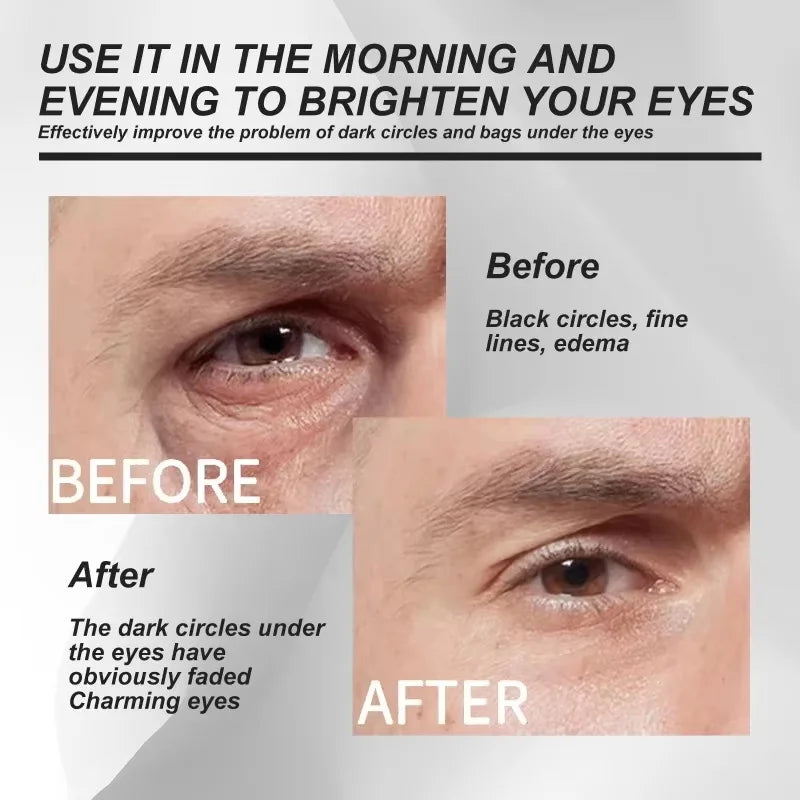 Eye Bag Removal Cream with Collagen Anti-Wrinkle Formula