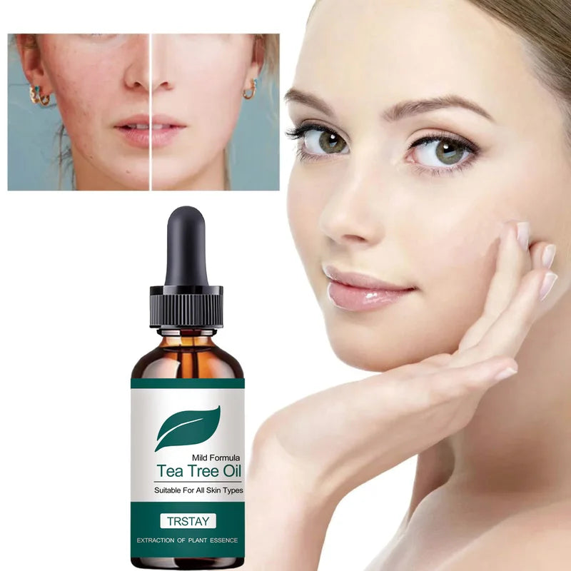 Gentle Tea Tree Oil for All Skin Types - Plant Extract Skincare, 15-50ml Variants