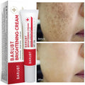 Whitening Face Cream for Dark Spots & Melasma - Brightening Skin Care 20g