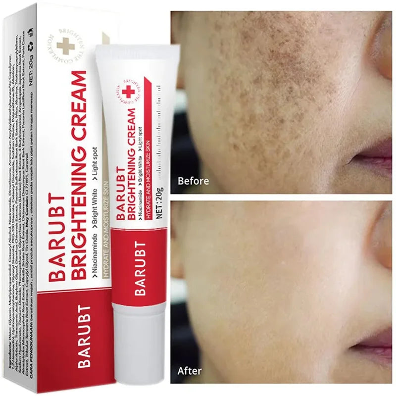Whitening Face Cream for Dark Spots & Melasma - Brightening Skin Care 20g