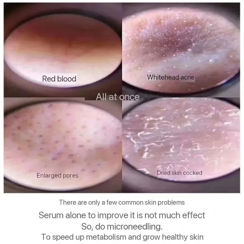 Collagen Skin Regeneration Powder Sponge - Natural Microcrystal Extract, Pore & Skin Renewal