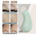 Blackhead and Whitehead Removal Tool for Nose and Face - Skin Pore Cleaner for Women