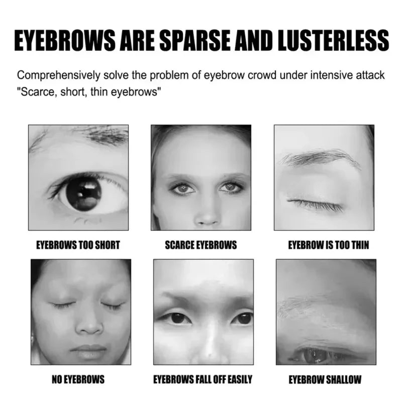 Eyebrow & Eyelash Growth Serum - Hair Loss Prevention & Fuller, Thicker Lengthening 30ml