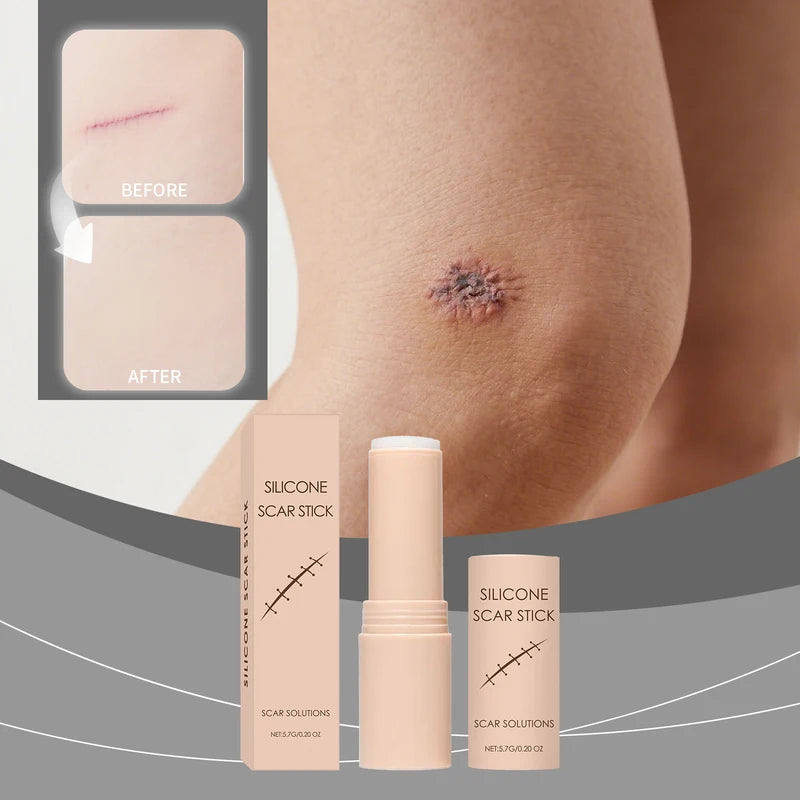 Portable Silicone Scar Stick for Face & Body Skin Repair, Reduce Allergies