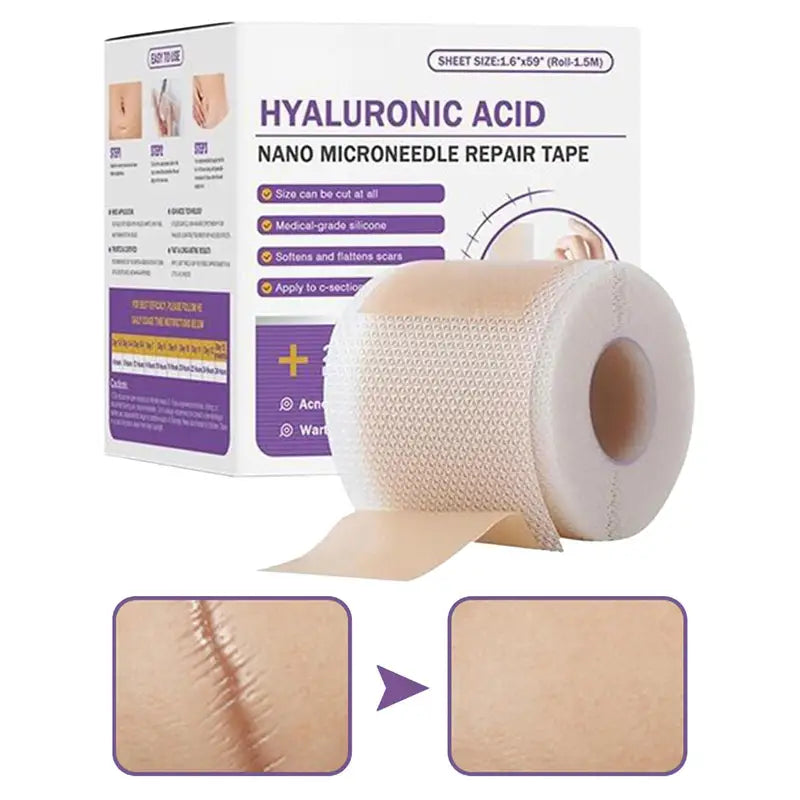 Silicone Scar Removal Patch - Gentle, Breathable Skin Repair Tape for Keloid, Burn & Trauma Scars