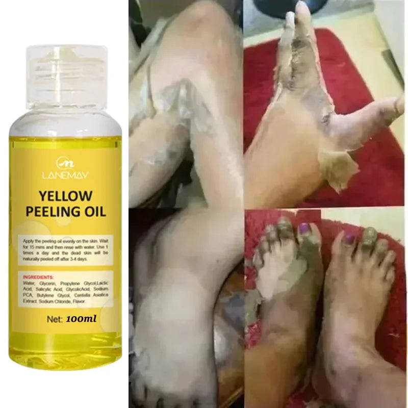Strong Yellow Peeling Oil for Skin Lightening & Exfoliation - Dark & Brightening Lotion