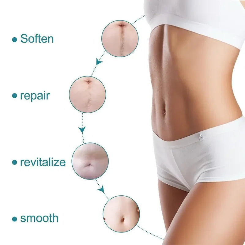 Silicone Scar Patch Roll for Skin Repair and Stretch Mark Removal - Self-Adhesive Therapy Tape