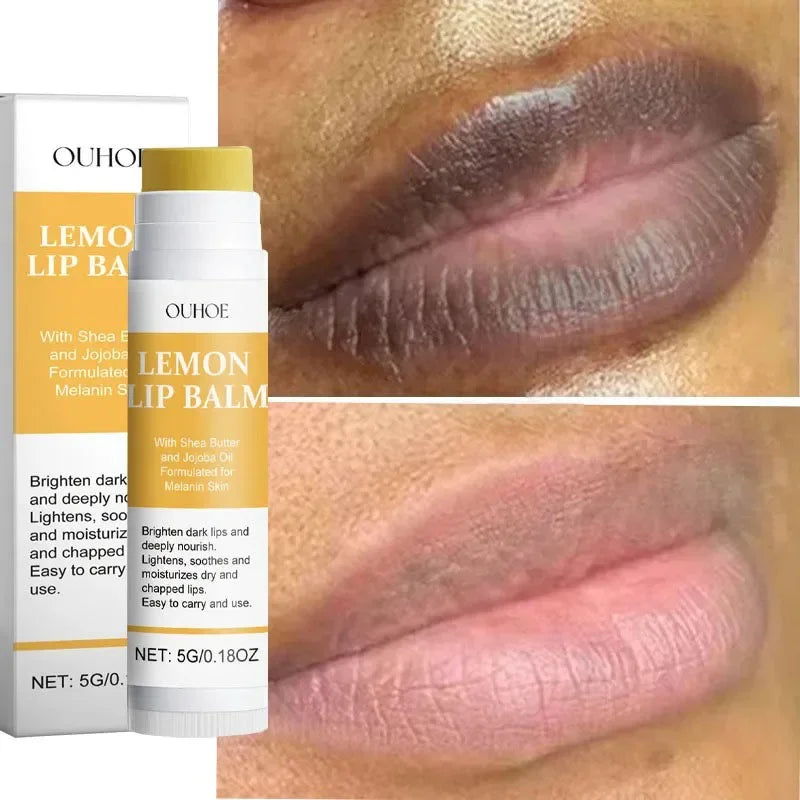 Dark Lip Balm Lightening & Moisturizing Lip Oil - Exfoliating & Brightening Korean Care