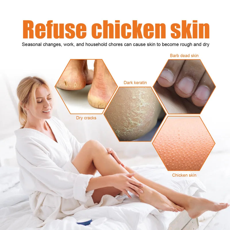 Foot Peeling Spray Exfoliates Dead Skin & Repairs Cracks - 100ml
