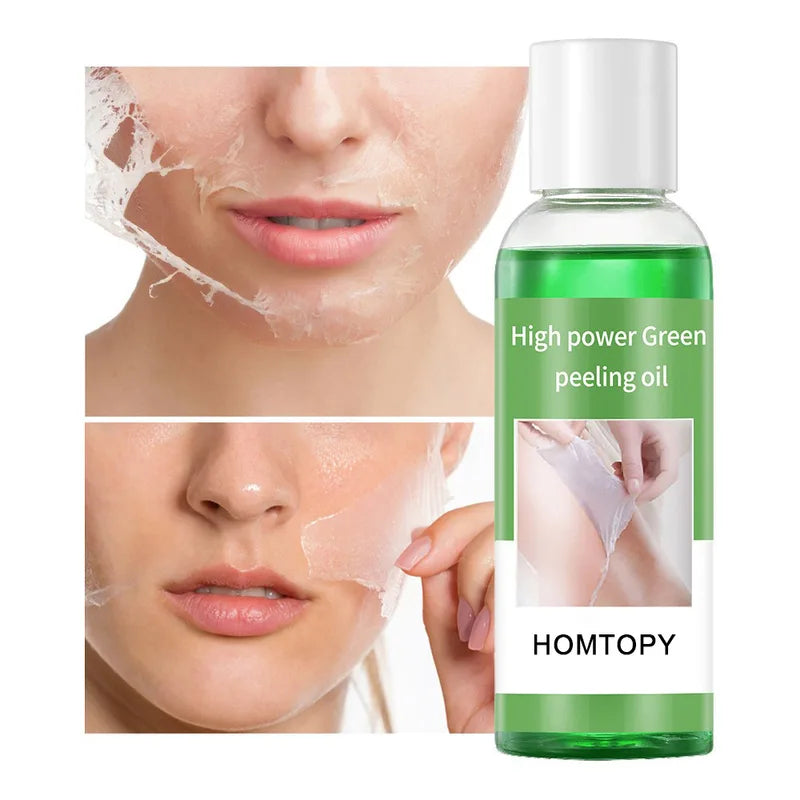 High Power Green Peeling Oil - Exfoliating, Moisturizing & Skin Brightening Oil