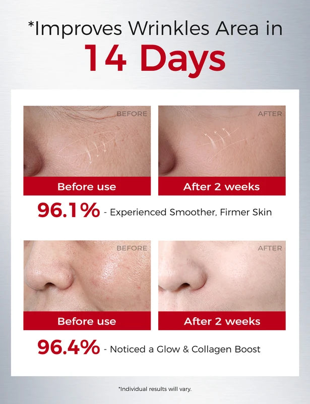 Retinol Anti-Aging Serum Set 3 x 30ml Night Wrinkle Repair & Firming