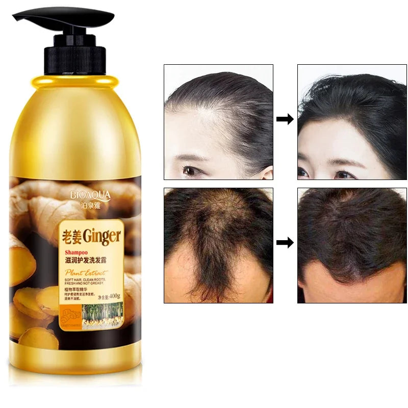 Herbal Ginger Hair Shampoo for Hair Growth & Dandruff Control 400ml