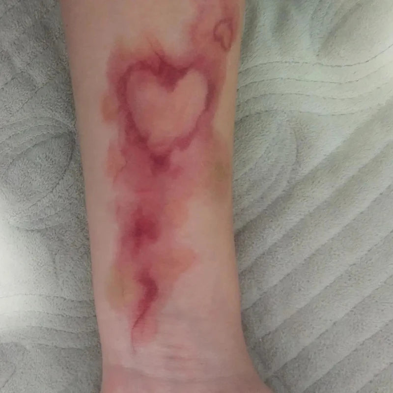 Heart Bruise Fake Tattoo for Women and Men Waterproof Arm Art Scar Blood Stasis Temporary Tattoo Set