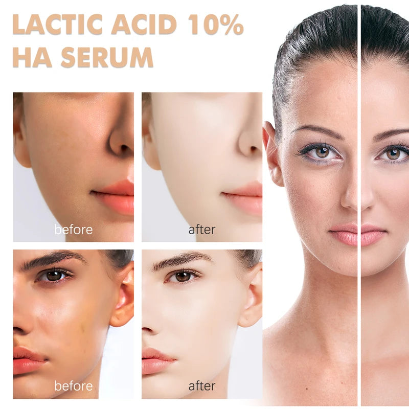 Lactic Acid Face Serum for Exfoliating Hydrating Brightening & Anti-Aging - All Skin Types