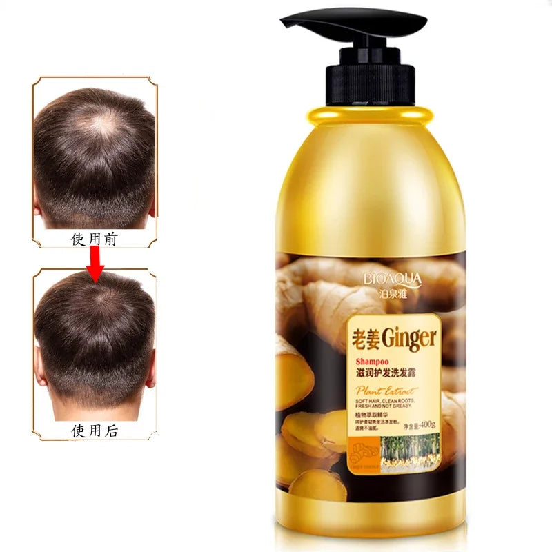 Herbal Ginger Hair Shampoo for Hair Growth & Dandruff Control 400ml