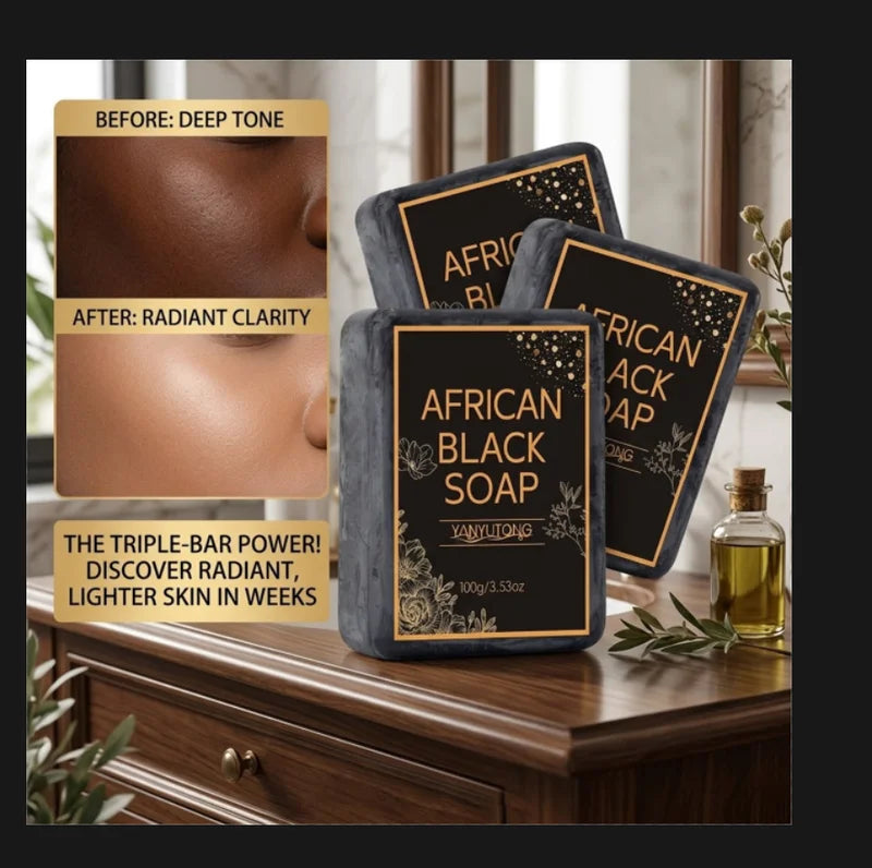 Moisturizing African Black Soap with Shea Butter Oil for Deep Cleansing & Skin Hydration
