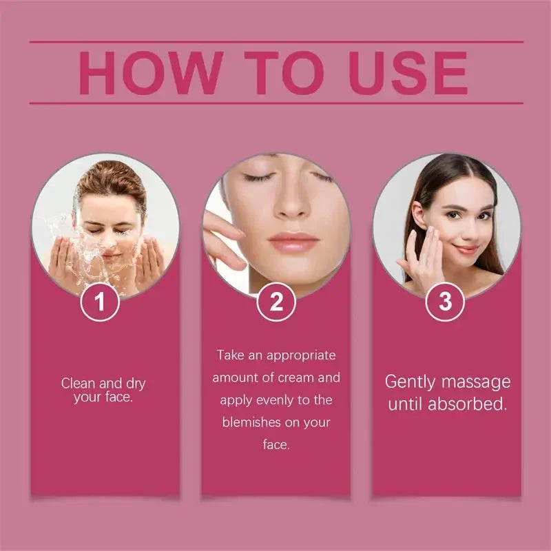 Powerful Skin Brightening Cream for Melasma Dark Spots & Pigmentation Removal - Korean Skin Care