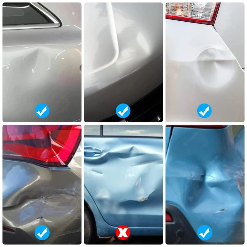 Car Dent Repair Kit - Paintless Body Ding Removal Tools with Suction Cups