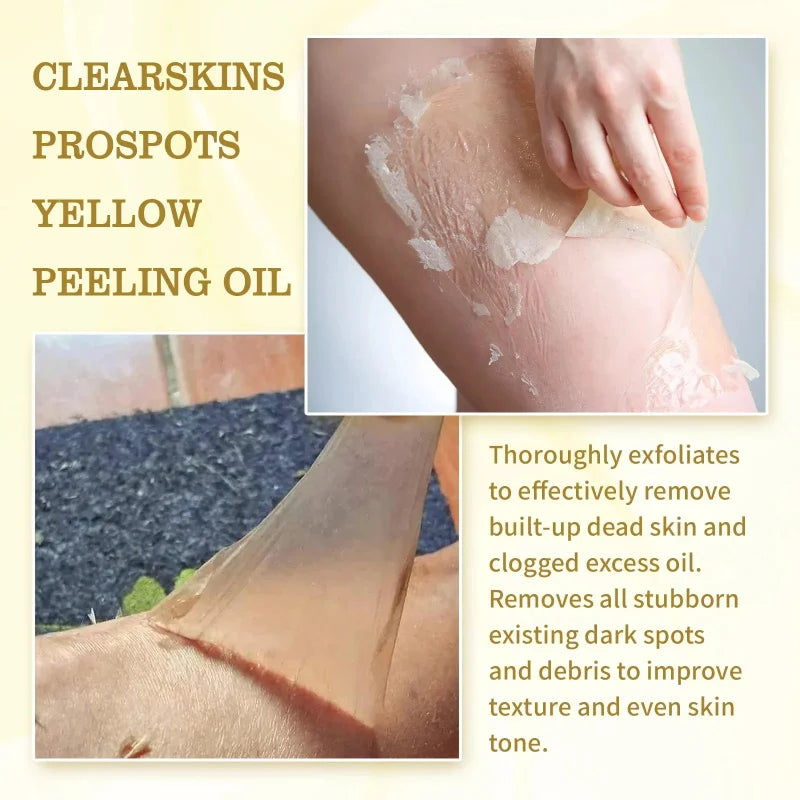 Strong Yellow Peeling Oil for Dark Skin Brightening & Exfoliation - Body & Hands