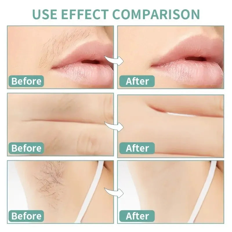 Facial Hair Removal Wax Strips Kit for Sensitive Skin - Quick & Painless